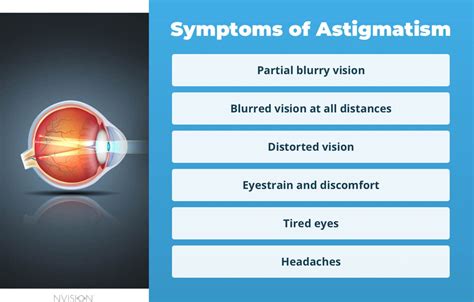 Astigmatism: Symptoms, Tests & Treatment .